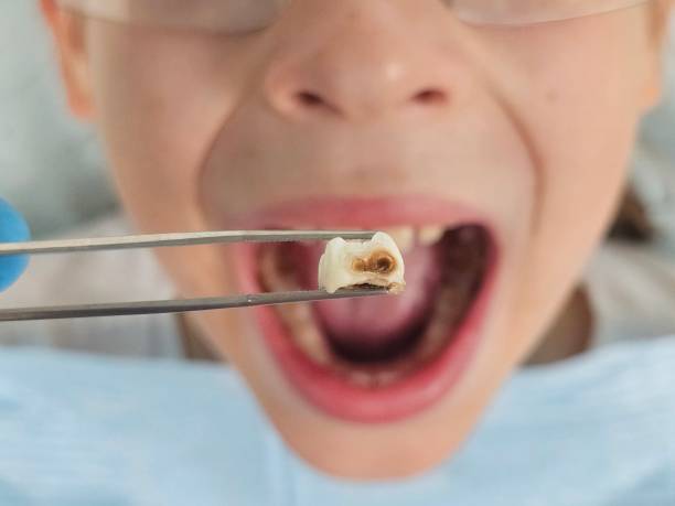 Best Emergency Dental Services for Seniors in Chackbay, LA